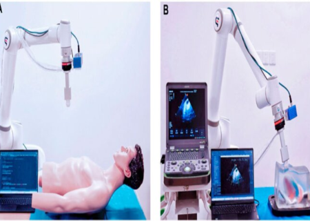 روبات محققان ایرانی عکسبرداری اولتراساوند را ایمن می کند