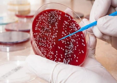 ابداع روش سه گانه برای درمان سرطان خون