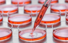 بهبود علائم و توانمندی‌های بیماران فلج مغزی و اتیسم با سلول‌درمانی