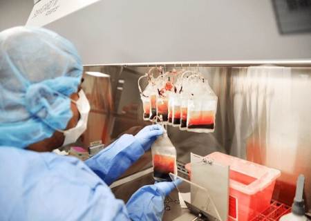 موفقیت ۸۰ درصدی درمان بیماری‌های خونی با نمونه‌های ذخیره‌شده بندناف