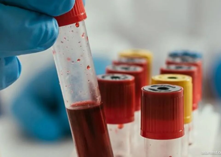 تولید آلبومین در پالایشگاه خون؛ صادرات کیت‌های تشخیصی به ۳ کشور